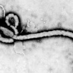 us-doctor-infected-with-ebola-critically-ill-but-says-he-is-‘cautiously-optimistic’