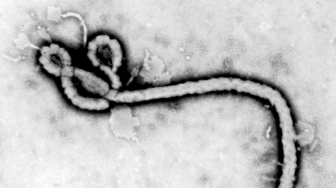 us-doctor-infected-with-ebola-critically-ill-but-says-he-is-‘cautiously-optimistic’