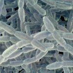 4th-person-dies-from-legionnaires’-disease-in-new-york-city:-health-officials